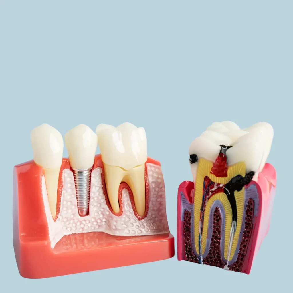 Dental Implants & Restorative Oral Surgery