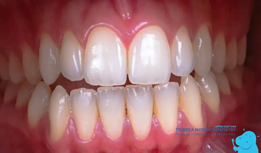 Common Causes of Tooth Pain