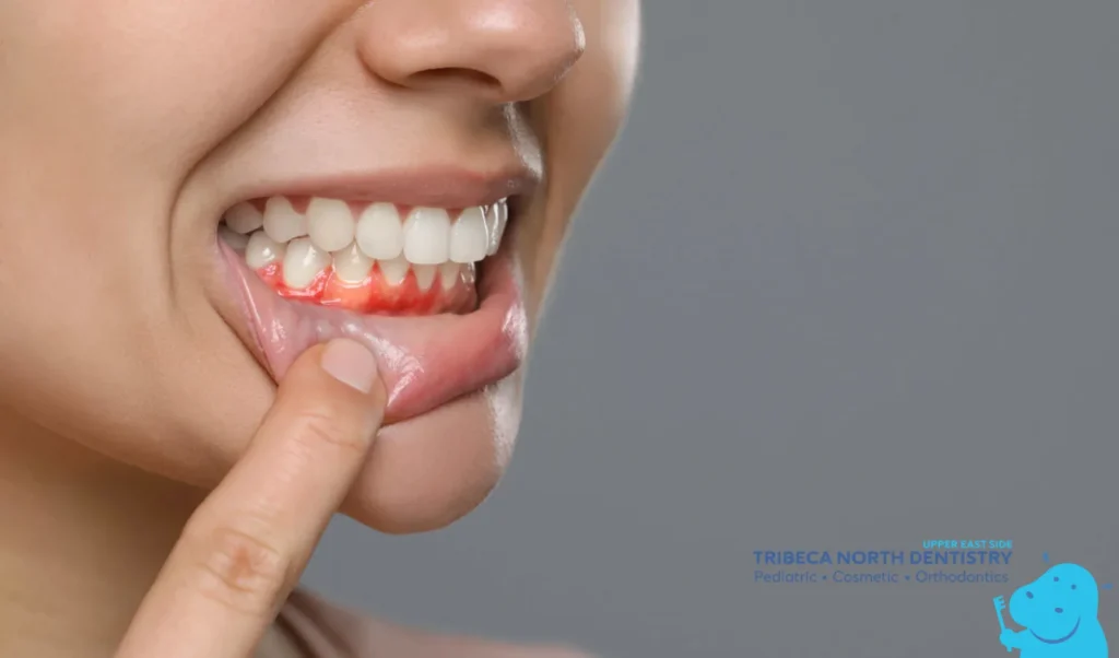 Common Causes of Toothache Pain