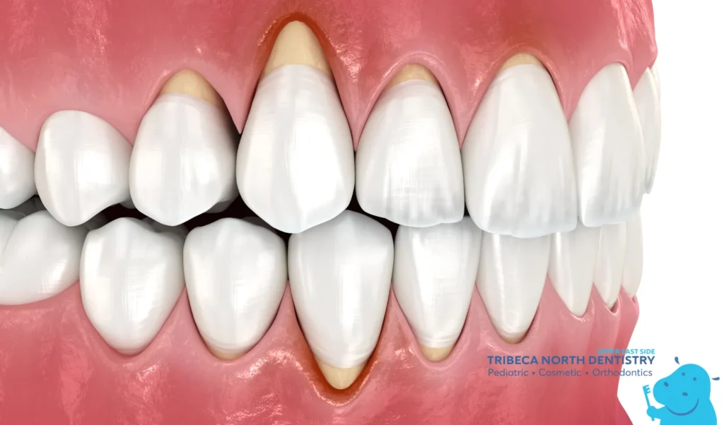 Common Reasons Your Teeth Hurt