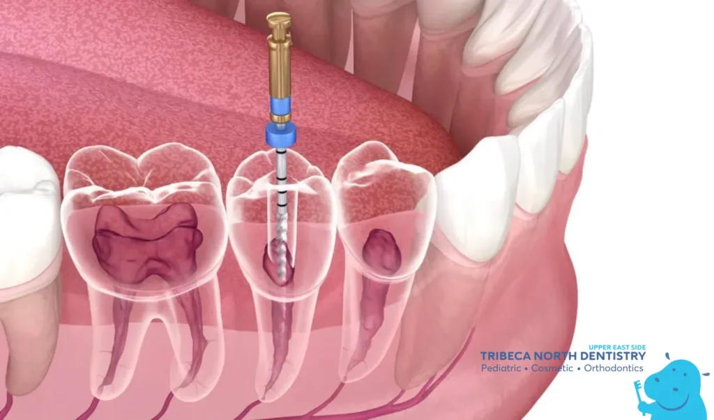 When Untreated Dental Problems Become Serious