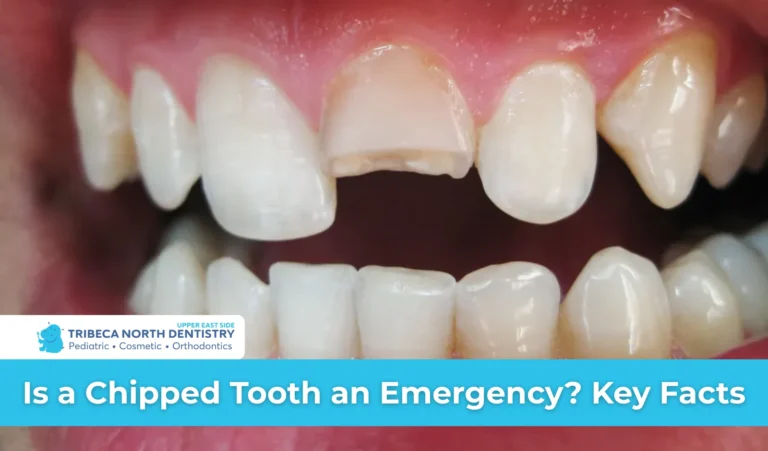 Is a Chipped Tooth an Emergency Key Facts