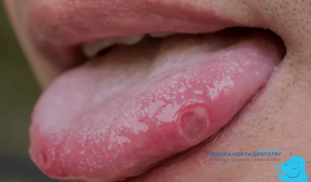 Symptoms You May Notice