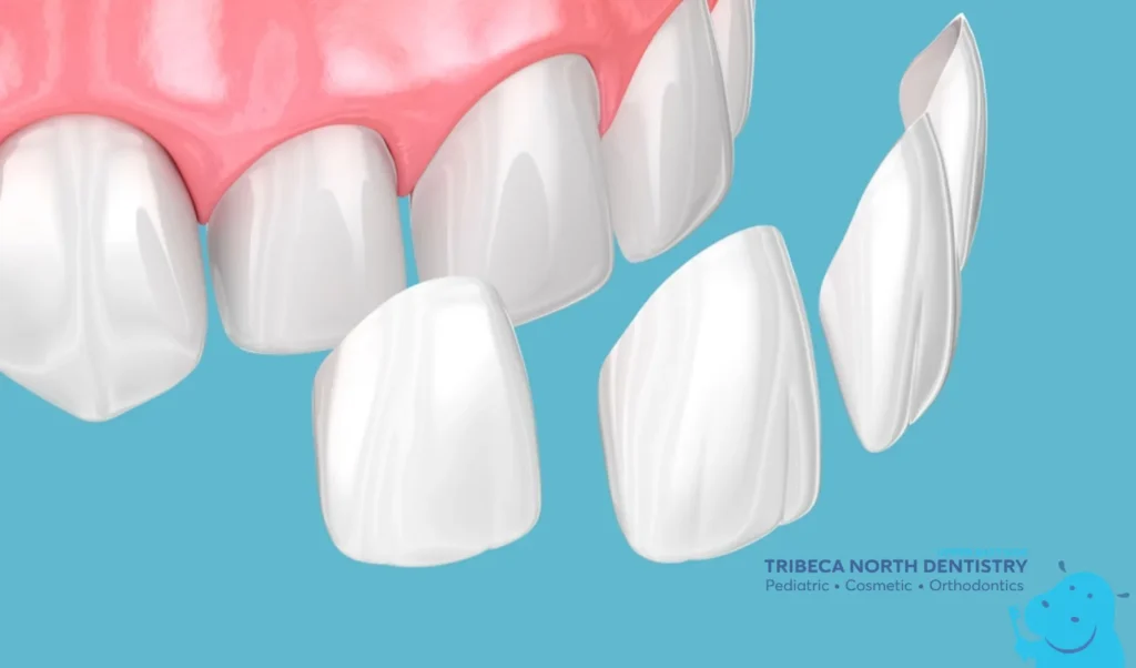 Treatment Options for a Chipped Tooth