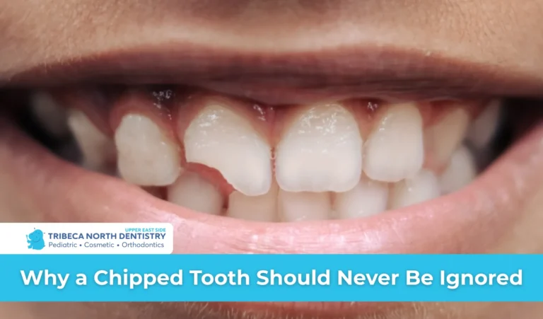 Why a Chipped Tooth Should Never Be Ignored