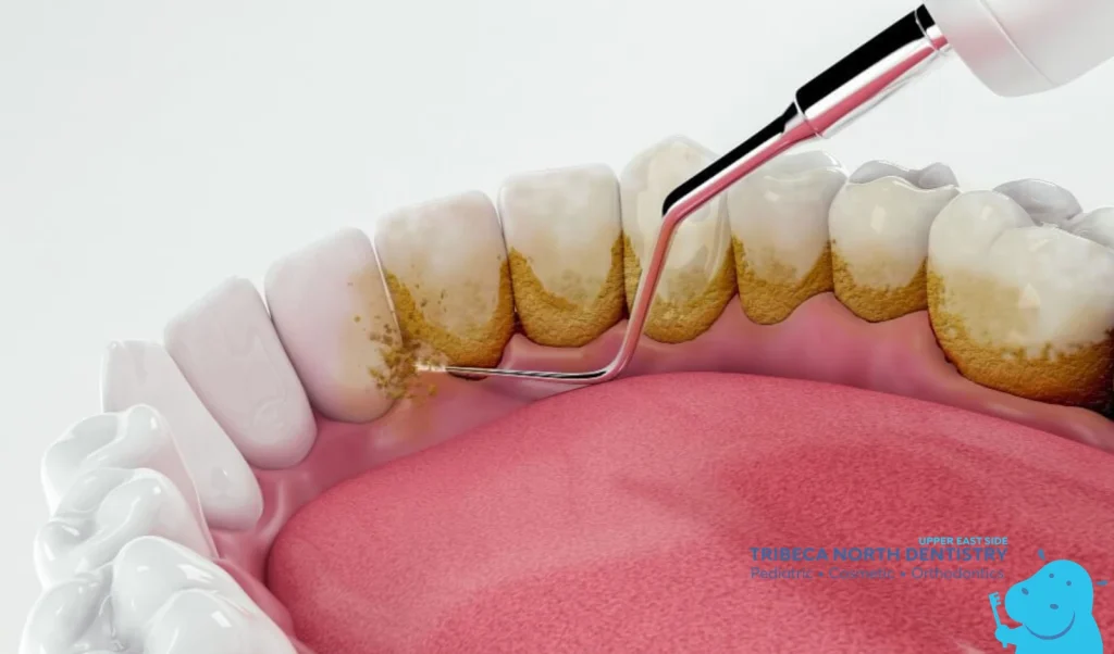 The Role of Teeth Cleaning and Preventive Care