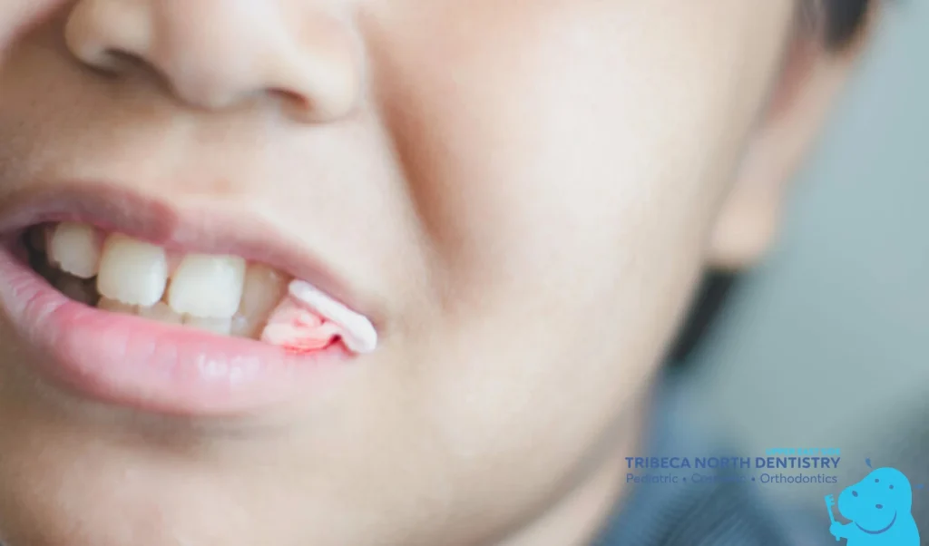 What Happens Right After a Tooth Is Removed