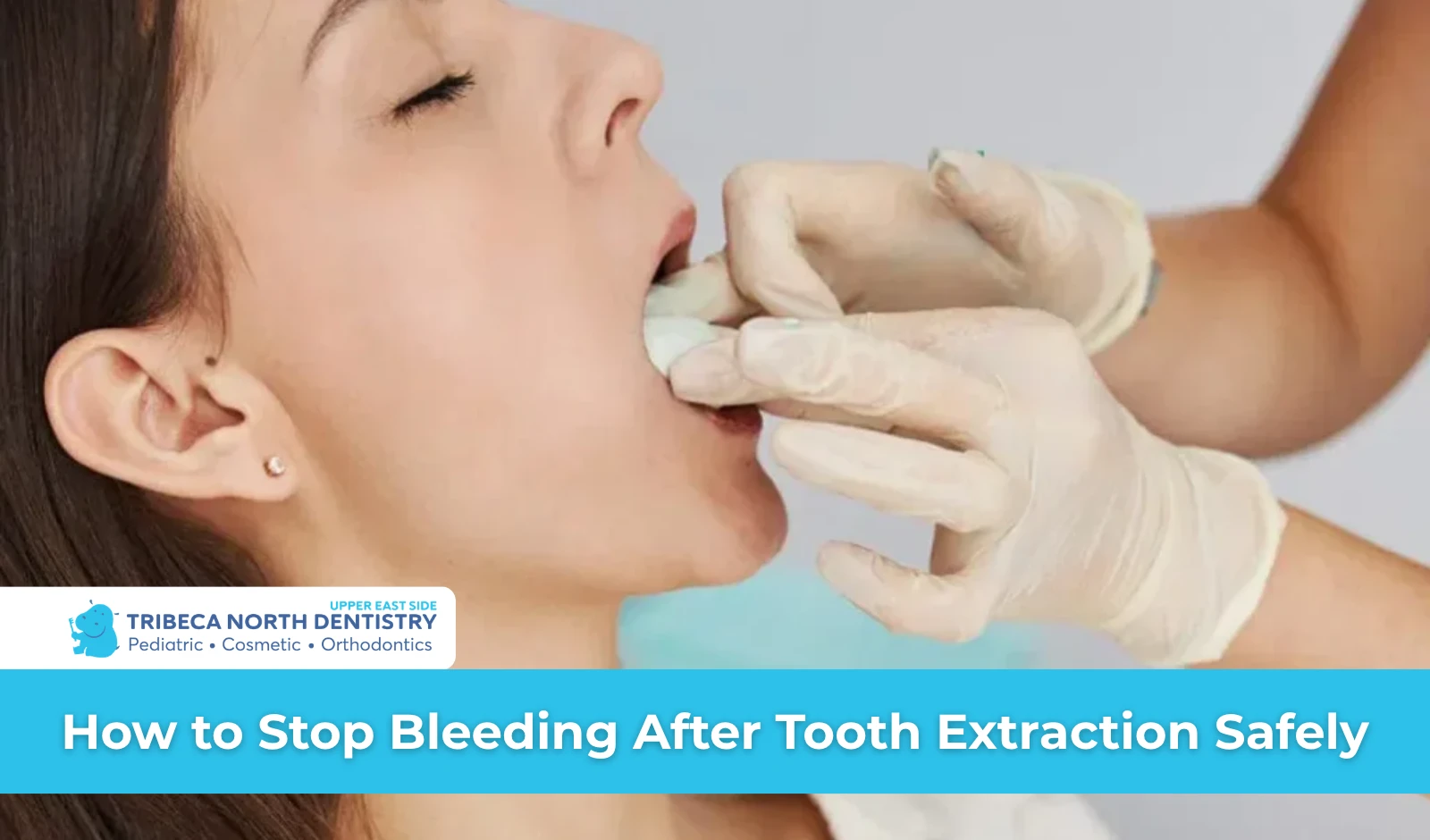 How to Stop Bleeding After Tooth Extraction Safely
